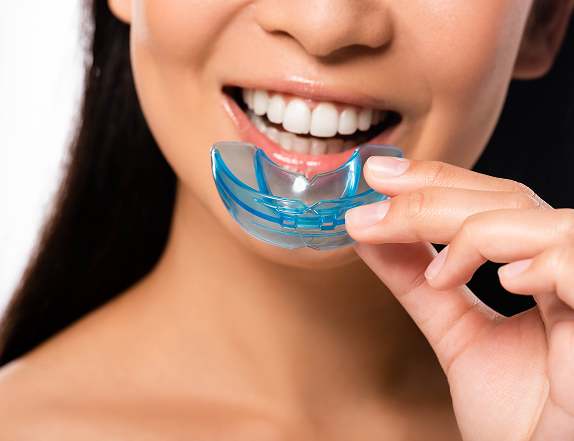 Close-up of a smiling woman holding a clear blue dental mouthguard over her teeth, illustrating oral care, teeth protection, and confidence.